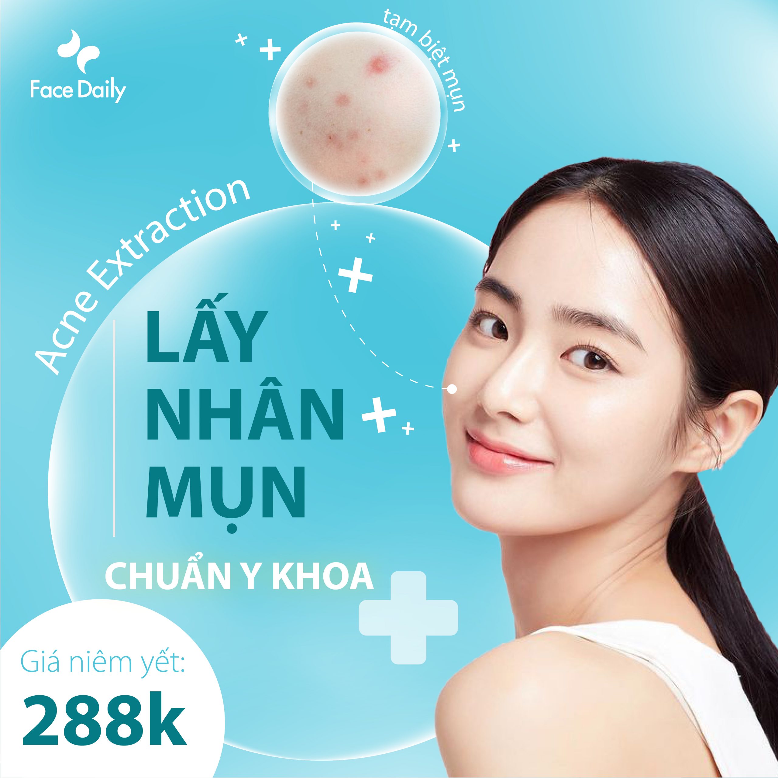 Acne Extraction – Lấy nhân mụn chuẩn y khoa